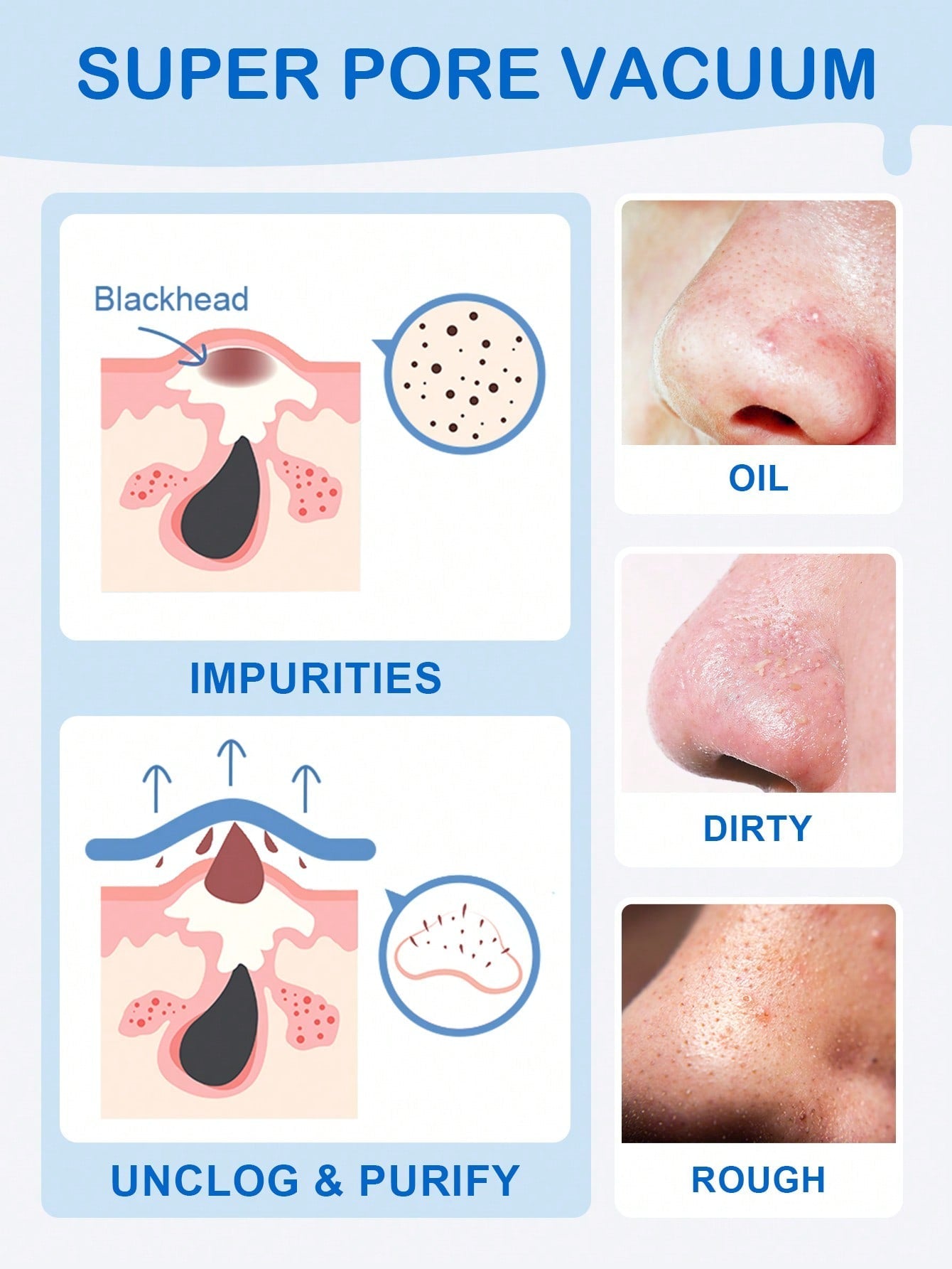 Shein - Slowsunday Blackhead Remover Nose Strips, Deep Cleanse And Refresh Your Skin, For Blackhead Removal On Oily Skin, With Instant Pore Unclogging, Features Natural Charcoal, 10Pcs - Black