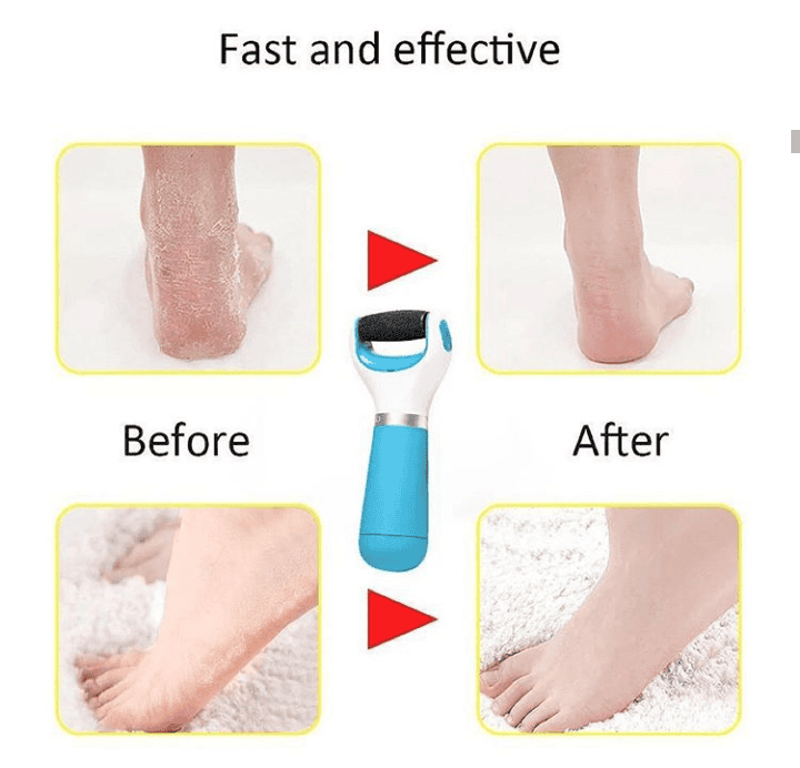 2 In 1 Electric Foot Filer Dry Foot Filer