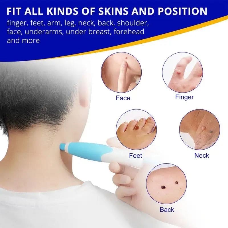 Skin Tag Remover, 2 In1 Painless Auto Skin Tag Remover, Mole Wart Removal Kit, Micro Skin Tag Remover
