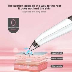 Black Spot Suction Vacuum, Blackhead Remover Cleaning Device, Electric Facial Pore Cleaner, Skincare Exfoliating Beauty Device, Facial Pore Acne Pimple Cleaner, Facial Tag Vacuum Suction, Household Professional Facial Pore Pimple Cleanser