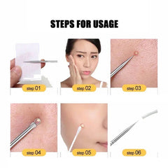 Set Of 4 Pimple Popper Needle, 4-In-1 Multifunctional Acne Needles, Blackhead Remover Tools, Spoon Face Skin Care Tools, Steel Blackhead Removal Kit, Women Beauty Acne Treatment Pore Cleanser Needle Hook, Comedone Extractor Remover Set for All Skin Types