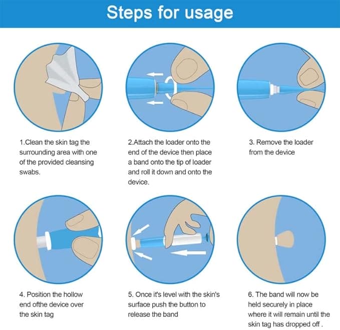 Skin Tag Remover, 2 In1 Painless Auto Skin Tag Remover, Mole Wart Removal Kit, Micro Skin Tag Remover