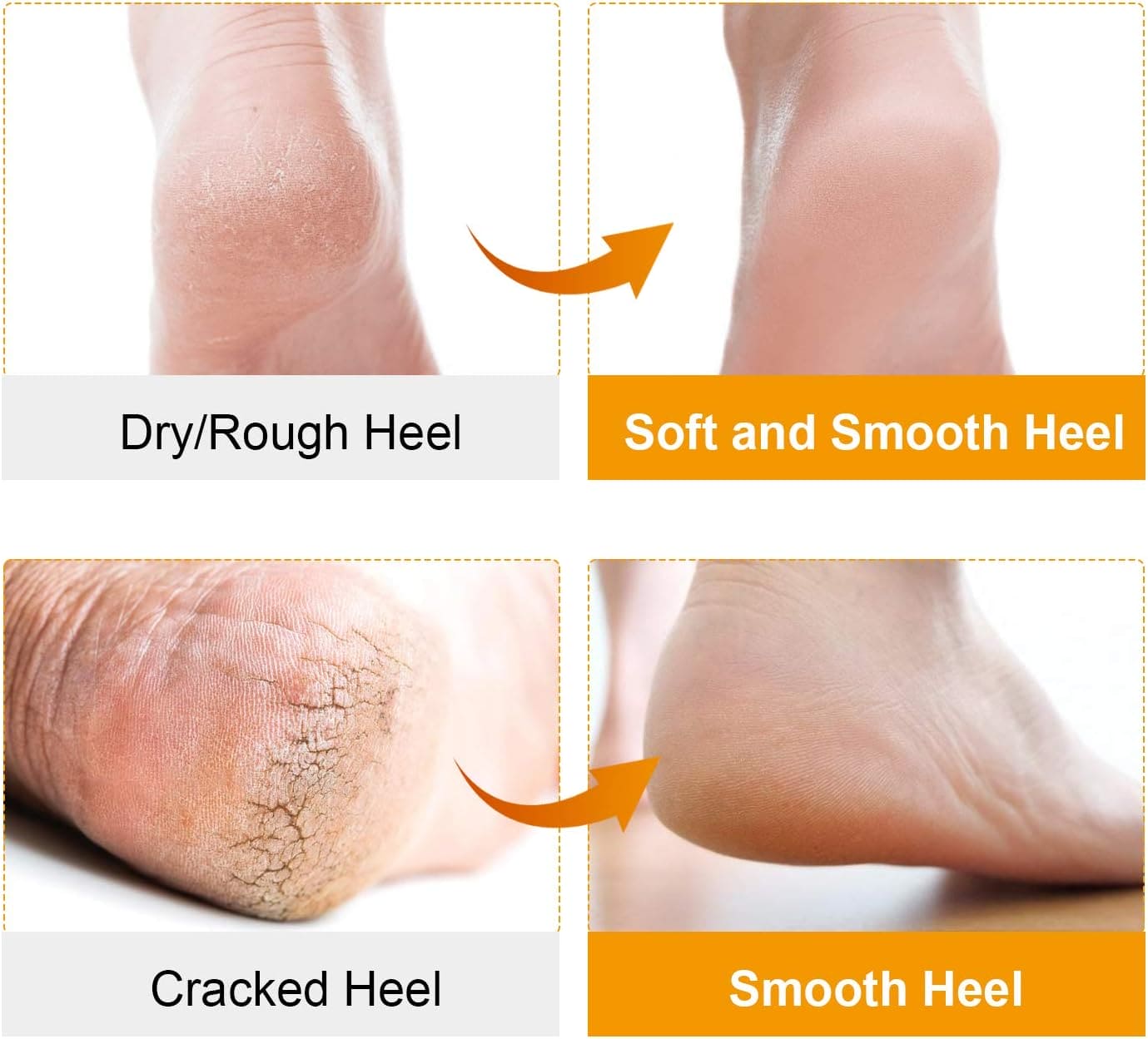 Pair Of Silicone Boat Heel Insole, Silicone Moisturizing Gel Sock, Anti Crack Protective Insole, Soft Open Toe Socks For Foot Care Protector, Shallow Boat Sock for Girls Ladies, Nonslip Gel Moisturizing Socks Foot Care